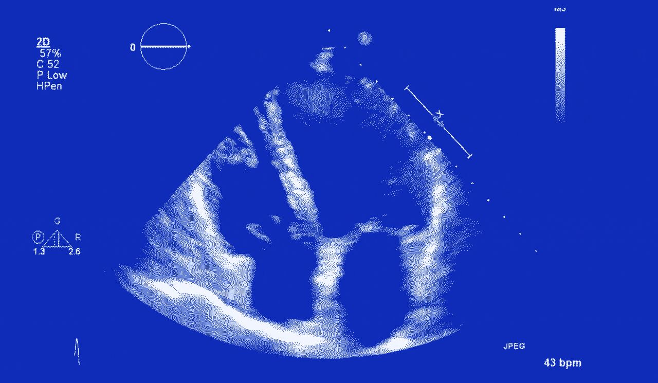Animated echocardiogram (heart ultrasound), the cover of the heart health edition